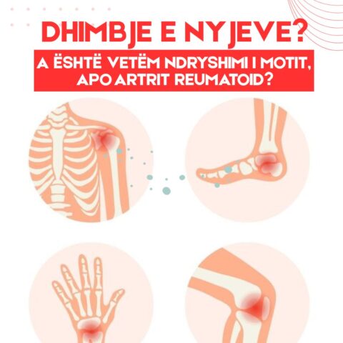 Mësoni rreth artritit reumatoid dhe ndikimit të tij në nyje