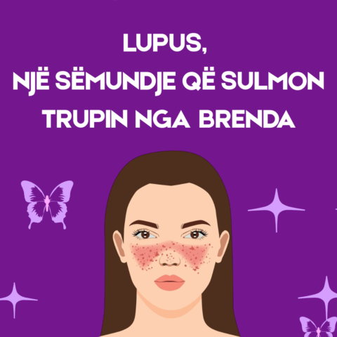LUPUS, NJË SËMUNDJE QË SULMON TRUPIN NGA BRENDA
