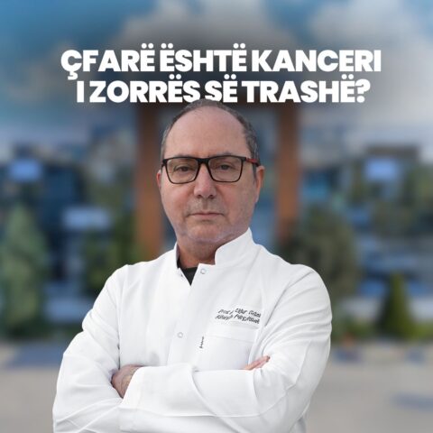 Çfarë është kanceri i zorrës së trashë?